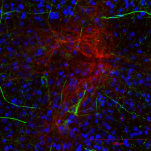 fluorecent image of cultured neurons and glial cells